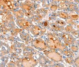 Immunohistochemistry (Formalin/PFA-fixed paraffin-embedded sections) - Anti-ACOX2 antibody (AB197808)