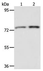 Western blot - Anti-ACOX2 antibody (AB197808)