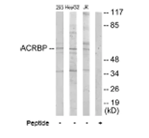 Western blot - Anti-ACRBP antibody (AB64809)