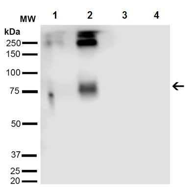 Western blot - Anti-Acrolein antibody [2H2] (AB240906), expandable thumbnail