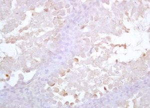 Immunohistochemistry (Formalin/PFA-fixed paraffin-embedded sections) - Anti-Acrosin antibody (AB203289)