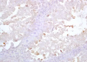 Immunohistochemistry (Formalin/PFA-fixed paraffin-embedded sections) - Anti-Acrosin antibody (AB203289)