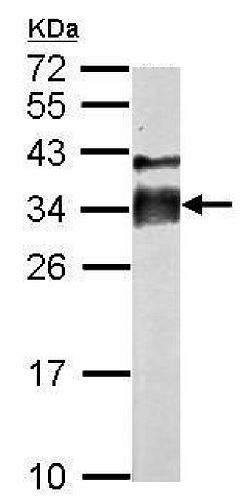 Western blot - Anti-ACRV1 antibody (AB228677)