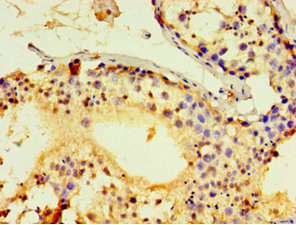 Immunohistochemistry (Formalin/PFA-fixed paraffin-embedded sections) - Anti-ACRV1 antibody (AB238863)