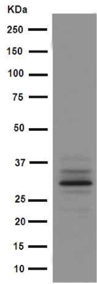Western blot - Anti-ACRV1 antibody [EPR15667(B)] - C-terminal (AB191075)