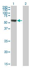 Western blot - Anti-ACSF3 antibody (AB73352), expandable thumbnail
