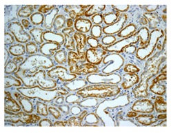 Immunohistochemistry (Formalin/PFA-fixed paraffin-embedded sections) - Anti-ACSL1 + ACSL6 antibody [EPR13499] (AB177958), expandable thumbnail