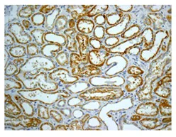 Immunohistochemistry (Formalin/PFA-fixed paraffin-embedded sections) - Anti-ACSL1 + ACSL6 antibody [EPR13499] (AB177958)