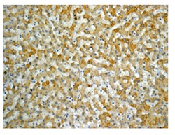 Immunohistochemistry (Formalin/PFA-fixed paraffin-embedded sections) - Anti-ACSL1 + ACSL6 antibody [EPR13499] (AB177958), expandable thumbnail