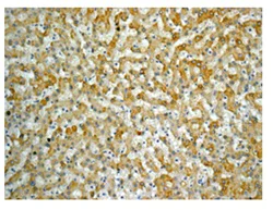Immunohistochemistry (Formalin/PFA-fixed paraffin-embedded sections) - Anti-ACSL1 + ACSL6 antibody [EPR13499] (AB177958)