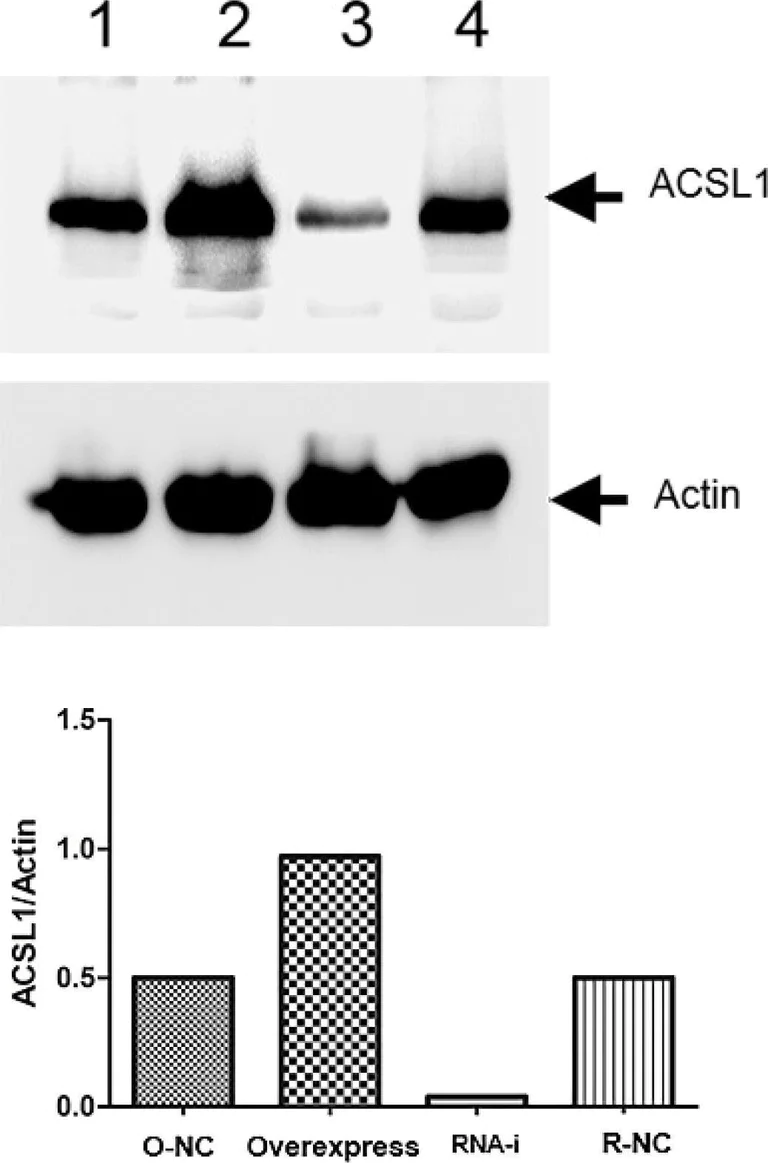 Western blot - Anti-ACSL1 + ACSL6 antibody [EPR13499] (AB177958)