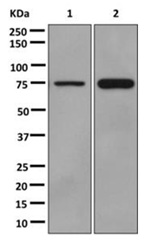 Western blot - Anti-ACSL1 + ACSL6 antibody [EPR13499] (AB177958), expandable thumbnail