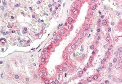 Immunohistochemistry (Formalin/PFA-fixed paraffin-embedded sections) - Anti-ACSL1 antibody (AB189939)