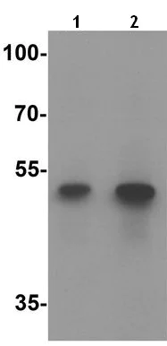 Western blot - Anti-ACSL1 antibody (AB189939)