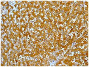 Immunohistochemistry (Formalin/PFA-fixed paraffin-embedded sections) - Anti-ACSL1 antibody [EPR13498] (AB178419)