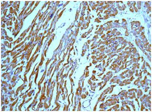 Immunohistochemistry (Formalin/PFA-fixed paraffin-embedded sections) - Anti-ACSL1 antibody [EPR13498] (AB178419)