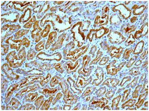 Immunohistochemistry (Formalin/PFA-fixed paraffin-embedded sections) - Anti-ACSL1 antibody [EPR13498] (AB178419)
