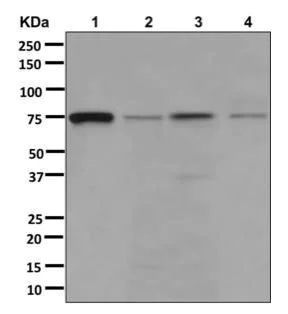 Western blot - Anti-ACSL1 antibody [EPR13498] (AB178419)