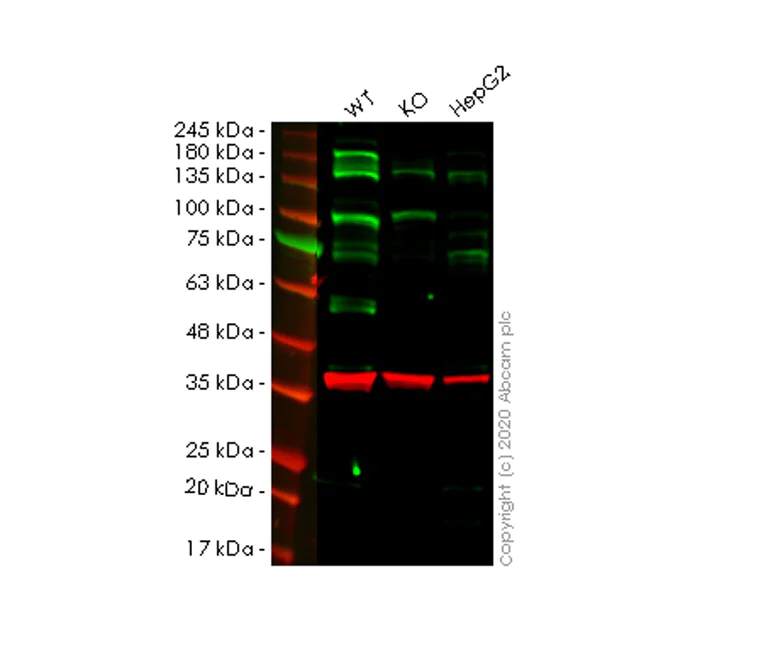 Western blot - Anti-ACSL1 antibody [EPR13498] - BSA and Azide free (AB250044)
