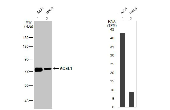 Western blot - Anti-ACSL1 antibody [HL1530] (AB308162)