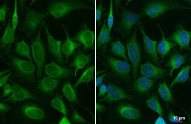Immunocytochemistry/ Immunofluorescence - Anti-ACSL3 antibody (AB151959)