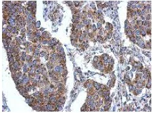 Immunohistochemistry (Formalin/PFA-fixed paraffin-embedded sections) - Anti-ACSL3 antibody (AB151959)