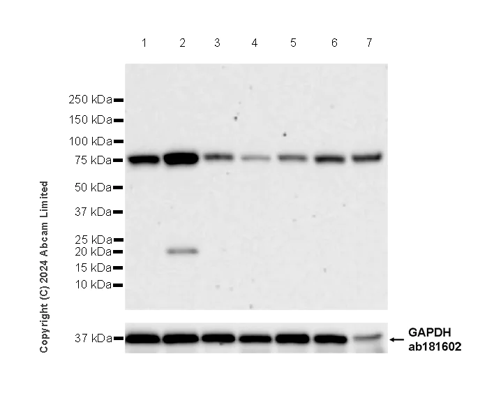 Western blot - Anti-ACSL3 antibody [EPR29199-39] (AB321811)
