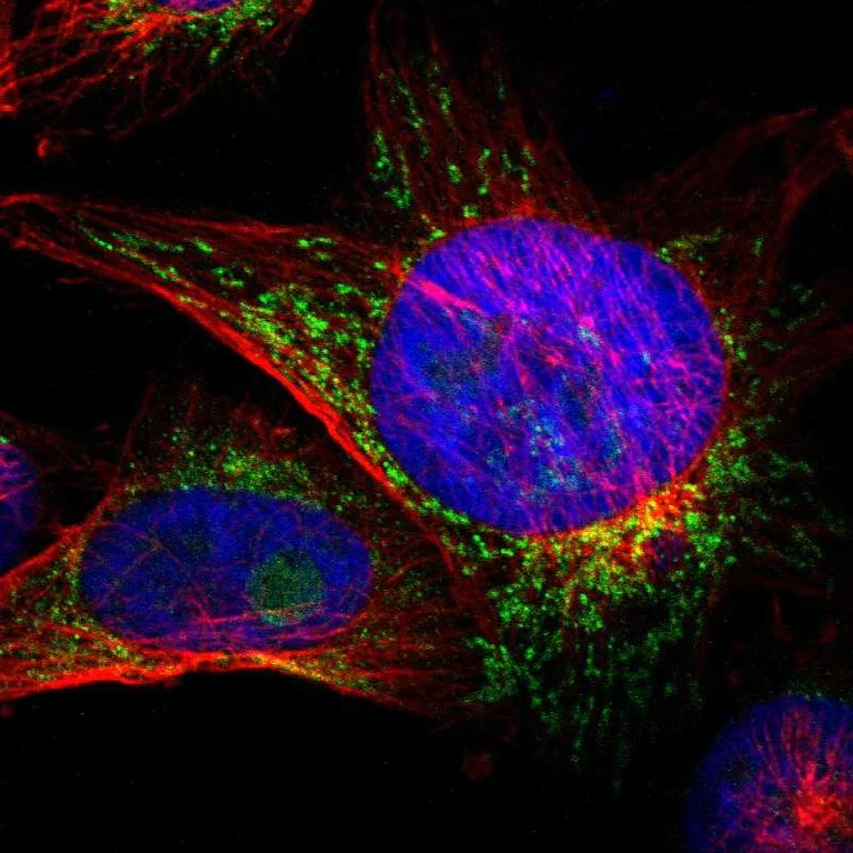Immunocytochemistry/ Immunofluorescence - Anti-ACSL5 antibody (AB272556)
