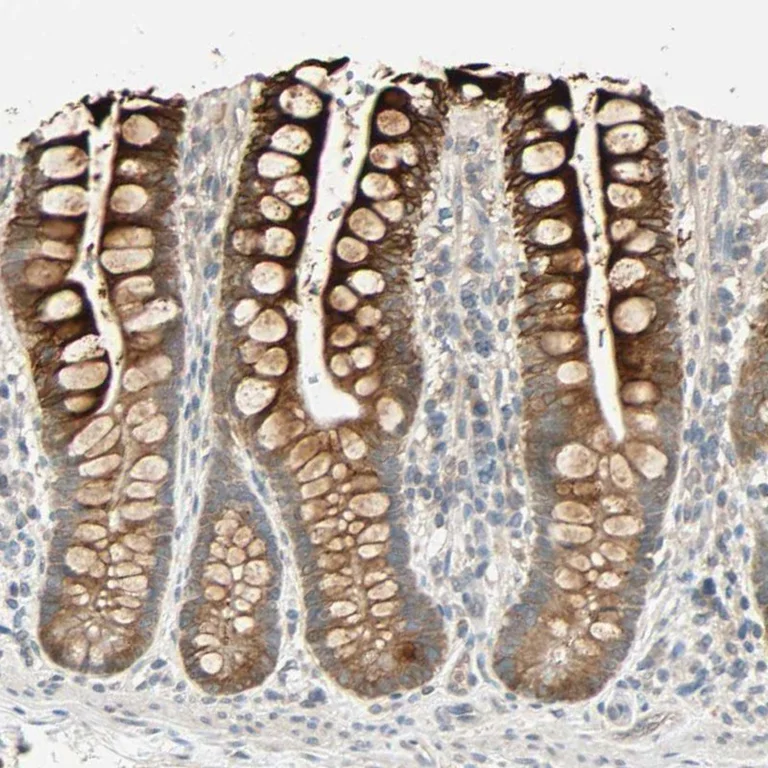 Immunohistochemistry (Formalin/PFA-fixed paraffin-embedded sections) - Anti-ACSL5 antibody (AB272556)