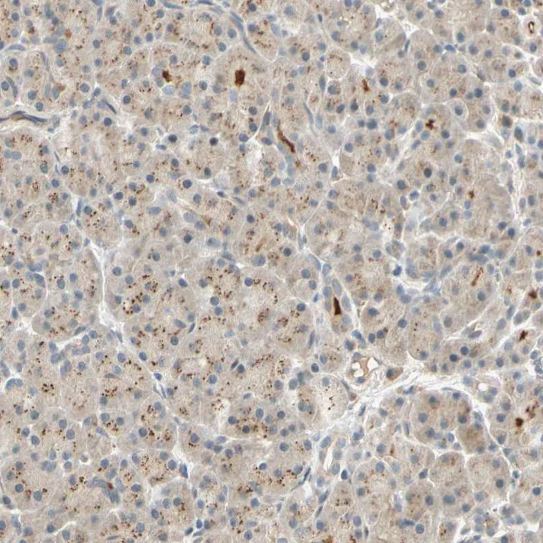 Immunohistochemistry (Formalin/PFA-fixed paraffin-embedded sections) - Anti-ACSL5 antibody (AB272556)