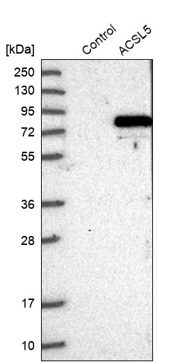 Western blot - Anti-ACSL5 antibody (AB272556)