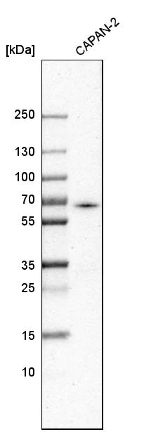 Western blot - Anti-ACSL5 antibody (AB272556)