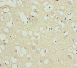 Immunohistochemistry (Formalin/PFA-fixed paraffin-embedded sections) - Anti-ACSL6/ACS2 antibody (AB229937)