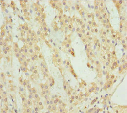 Immunohistochemistry (Formalin/PFA-fixed paraffin-embedded sections) - Anti-ACSL6/ACS2 antibody (AB229937)