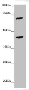Western blot - Anti-ACSL6/ACS2 antibody (AB229937)