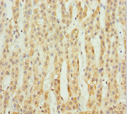 Immunohistochemistry (Formalin/PFA-fixed paraffin-embedded sections) - Anti-ACSL6/ACS2 antibody (AB229958), expandable thumbnail