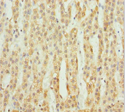 Immunohistochemistry (Formalin/PFA-fixed paraffin-embedded sections) - Anti-ACSL6/ACS2 antibody (AB229958)