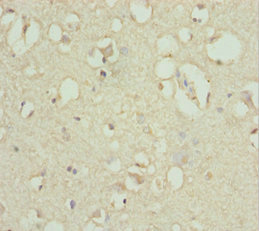 Immunohistochemistry (Formalin/PFA-fixed paraffin-embedded sections) - Anti-ACSL6/ACS2 antibody (AB229958), expandable thumbnail