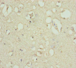 Immunohistochemistry (Formalin/PFA-fixed paraffin-embedded sections) - Anti-ACSL6/ACS2 antibody (AB229958)