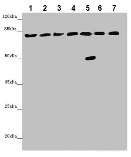 Western blot - Anti-ACSL6/ACS2 antibody (AB229958), expandable thumbnail