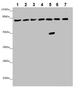 Western blot - Anti-ACSL6/ACS2 antibody (AB229958)