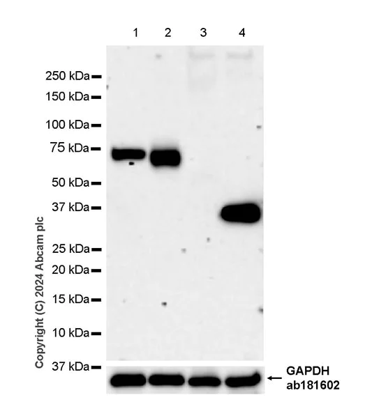 Western blot - Anti-ACSL6/ACS2 antibody [EPR29174-76] (AB317703)