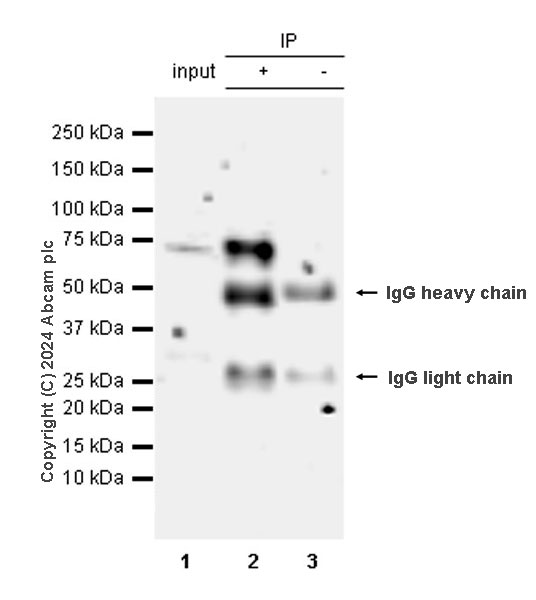 Immunoprecipitation - Anti-ACSL6/ACS2 antibody [EPR29174-76] - BSA and Azide free (AB317704), expandable thumbnail