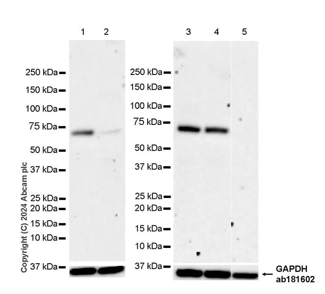 Western blot - Anti-ACSL6/ACS2 antibody [EPR29174-76] - BSA and Azide free (AB317704)