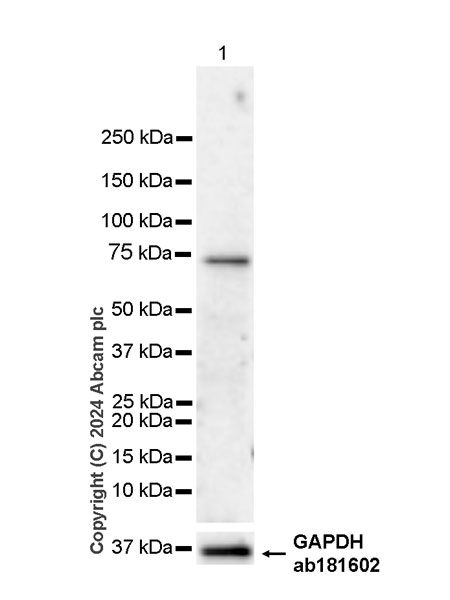 Western blot - Anti-ACSL6/ACS2 antibody [EPR29174-76] - BSA and Azide free (AB317704), expandable thumbnail