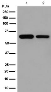 Western blot - Anti-ACSM2A antibody [EPR13330-17] (AB181865), expandable thumbnail