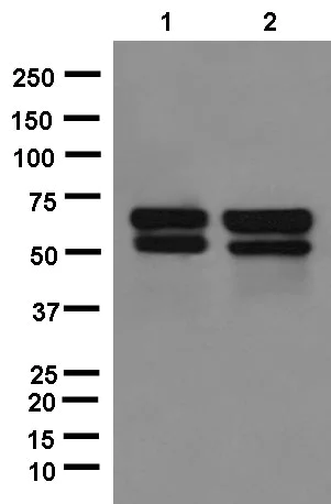 Western blot - Anti-ACSM2A antibody [EPR13330] - BSA and Azide free (AB250424)