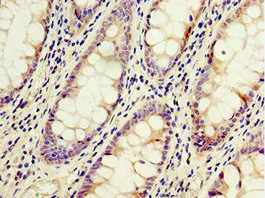 Immunohistochemistry (Formalin/PFA-fixed paraffin-embedded sections) - Anti-ACSM3/SAH antibody (AB238682)