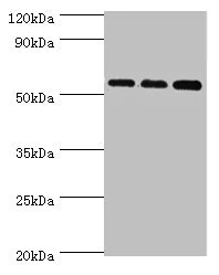 Western blot - Anti-ACSM3/SAH antibody (AB238682)
