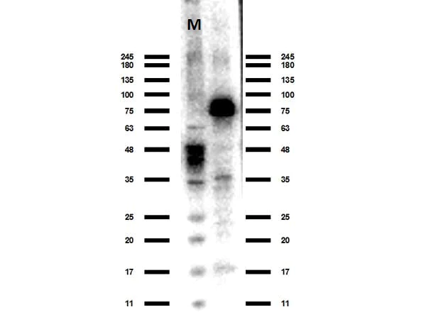 Western blot - Anti-ACSS2 antibody (AB263966)